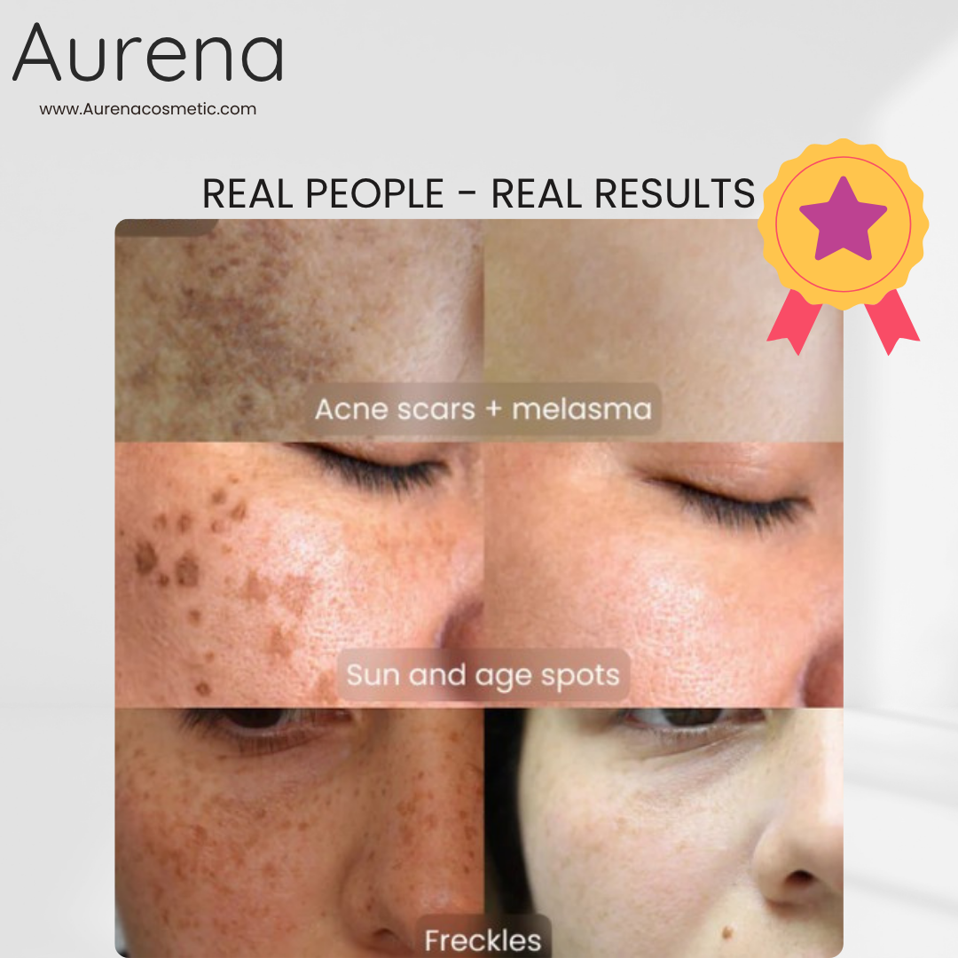 Aurena™ - VITAMIN C WHITENING