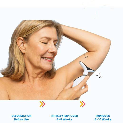 Aurena™ Arm Slimming