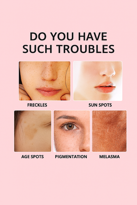Aurena™ - VITAMIN C WHITENING FRECKLES