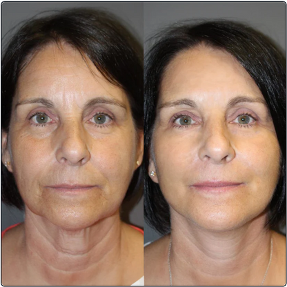 Nutrilofie Moisturizer